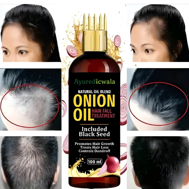 Ayurvedicwala Onion Hair Oil with Black Seed – Natural Hair Fall Treatment (100ml)