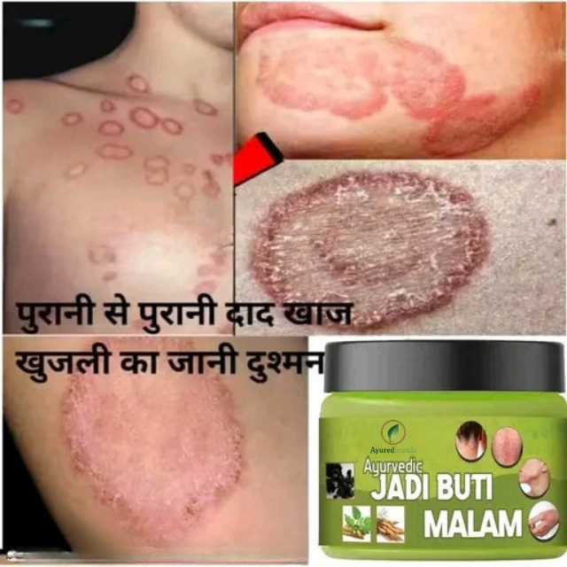 Ayurvedicwala Jadi Buti Malam – Herbal Skin Care Balm (50g)